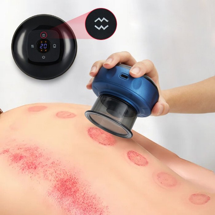 CelluSculpt Pro | Masseur à ventouses anti-cellulite